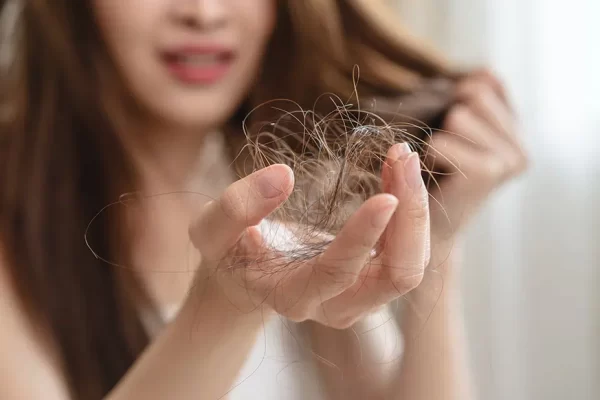 Studi: Minuman Manis dan Alkohol Bisa Memicu Rambut Rontok